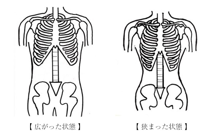 肋骨矯正について